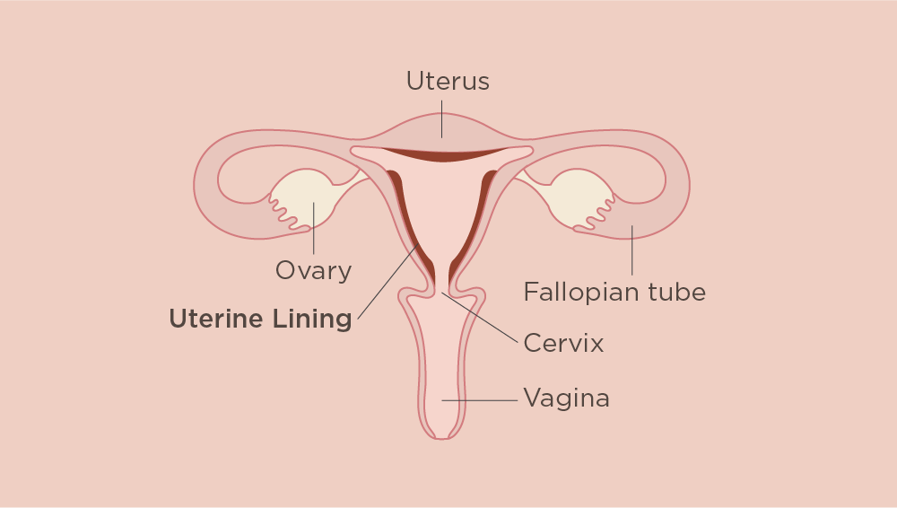 Diagram of the uterus and uterine lining