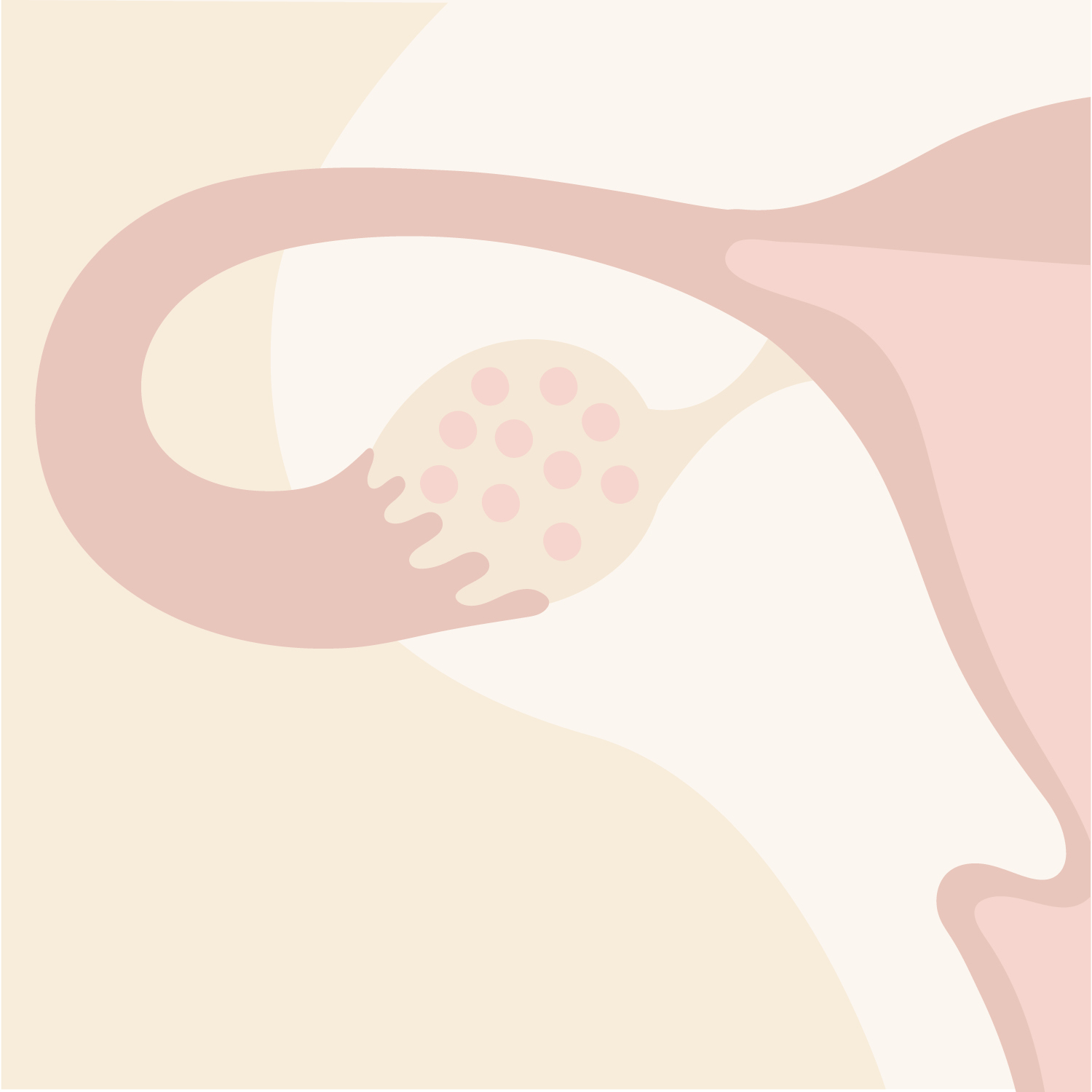UNDERSTANDING PCOS