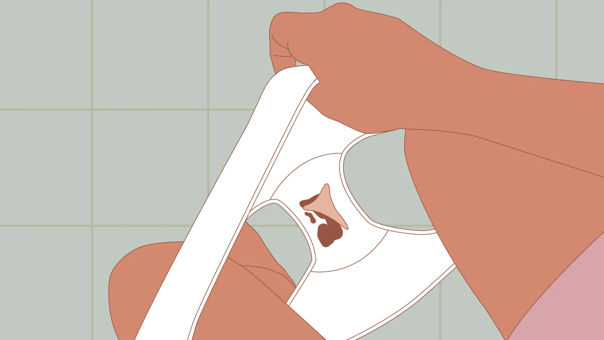 DECIDUAL CAST PERIODS: WHEN YOUR UTERINE LINING SHEDS AS ONE