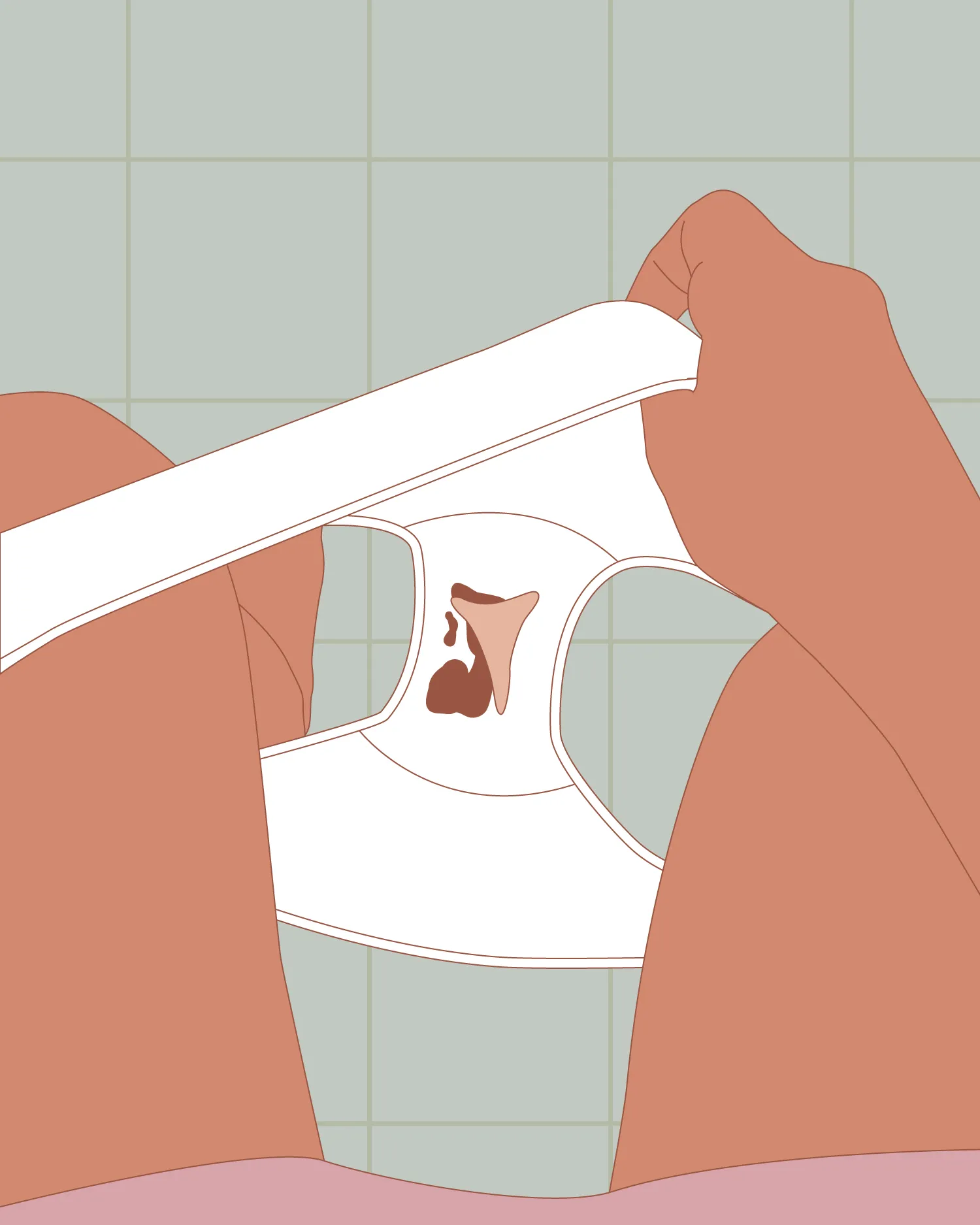DECIDUAL CAST PERIODS: WHEN YOUR UTERINE LINING SHEDS AS ONE