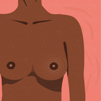 Why Are My Breasts Sore Before My Period? Common Causes Explained